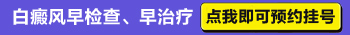 白癜风治疗中还长新的白斑是什么原因