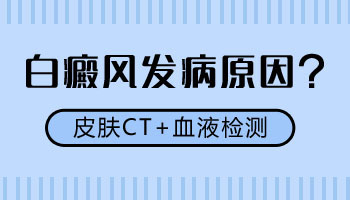 白癜风治疗中还长新的白斑是什么原因