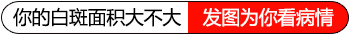 手上有很多白斑和什么有关系 什么方法能治好白斑