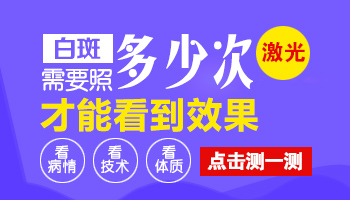 手关节的白癜风打308激光需要打多少次