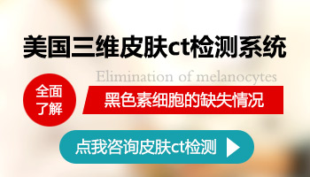 胳膊外侧长白斑三四年了怎么办