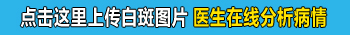 白癜风照308激光多久照一回比较好