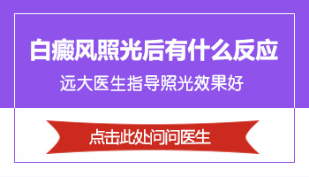 308照射白斑后皮肤内部肿胀能涂抹膏药吗