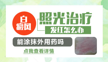 308照完白癜风照红了摸啥药好