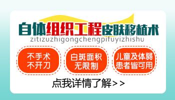 白癜风有一年多容易治疗吗