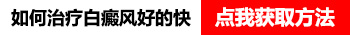 白癜风有一年多容易治疗吗