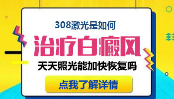 白癜风照308激光以后没有反应该怎么办