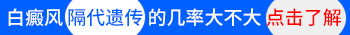 白癜风隔2代遗传几率