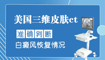 伍德灯检查白斑说是白癜风一定准确吗