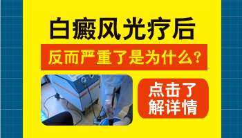 额头白癜风照光疗仪照伤之后还扩大了