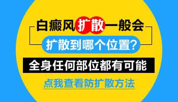 肢端型白癜风会扩散到脸部吗