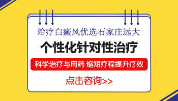 石家庄治白斑比较好的医院