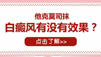 治疗白癜风他克莫司买什么浓度的好