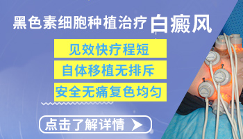 头部白癜风能做黑色素细胞移植吗