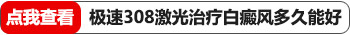 308光疗仪照白斑一次大概多少钱