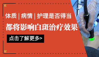 白癜风可以用什么粉底遮盖白斑