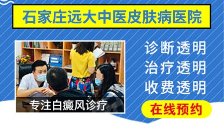 「治白斑排行榜」石家庄白癜风医院