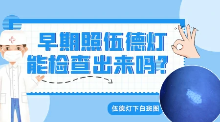 白癜风是光滑的吗 早期白斑鉴别