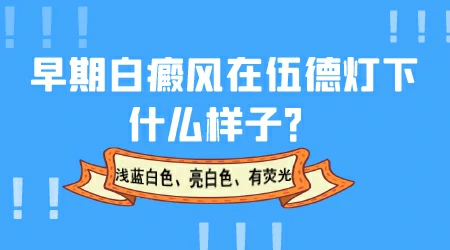 伍德灯下亮白色是不是白癜风