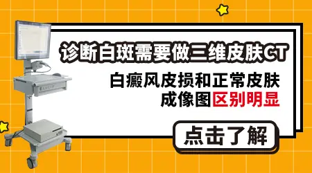 伍德灯下亮白色是不是白癜风