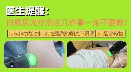 311光疗照白癜风会越照越严重吗