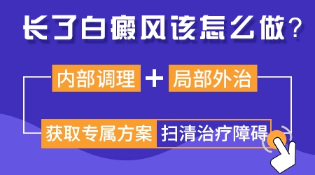 白癜风一开始就很白还是慢慢变白