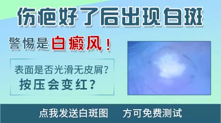 摔伤后皮肤发白是怎么回事