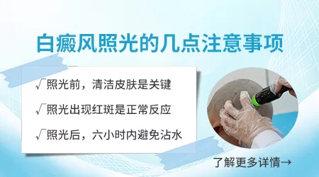 308激光治疗白斑照几次可以长出黑点