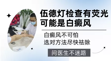 wood灯检查亮白色荧光什么意思