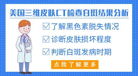 医院什么仪器检查白癜风更准确