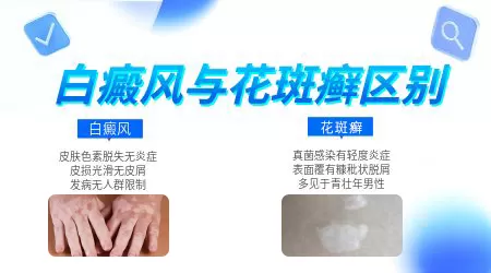 白癜风图片和汗斑图片