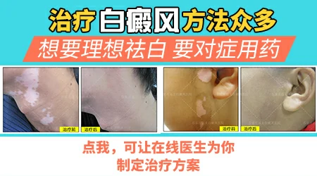 男性生殖器官白斑怎么治