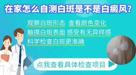 诊断皮肤白斑的方法 白斑自测