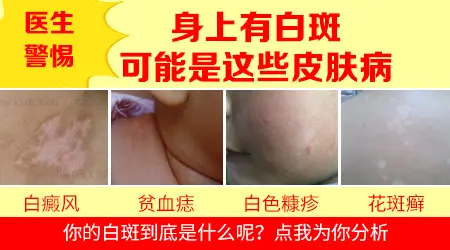 脖子上长了一小片白色是什么病