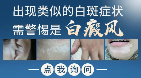 手背上出现白色小点是什么原因