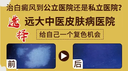 稳定期白癜风还会不会扩散