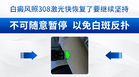 308准分子激光治疗收费价格