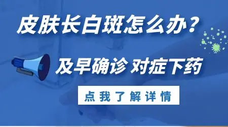 皮肤ct能检查白斑是不是白癜风吗