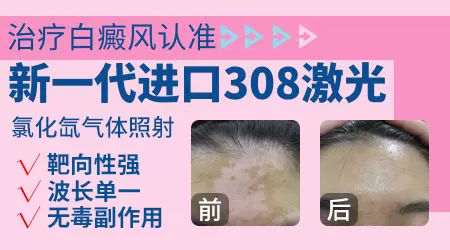 308准分子激光多少钱一个光斑