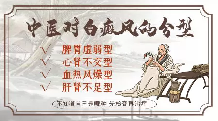 石家庄看白癜风有没有好中医