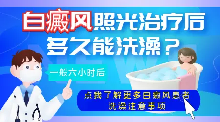 白癜风照308激光多长时间能洗澡