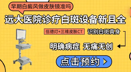 皮肤镜和伍德灯哪个检查白斑准