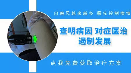 白癜风边缘变得模糊是要发展还是好转