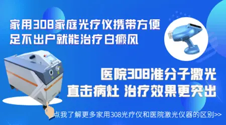 家用白癜风治疗仪有用吗