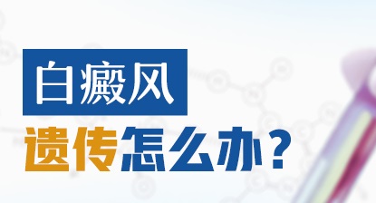 白癜风遗传是小孩一出生就会有白斑吗