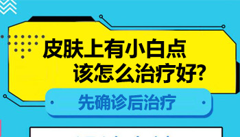 孩子四岁半脸上有白块不知道怎么治疗