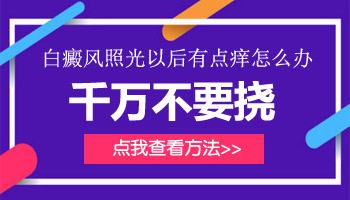 儿童白癜风照了308痒是怎么回事