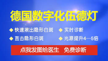 照wood灯说白斑不是白癜风准确吗