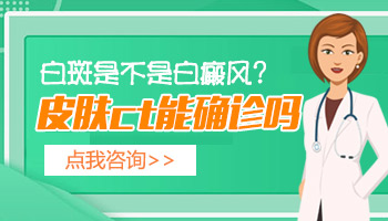 CT下怎么辨别白斑是不是白癜风