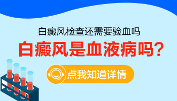 伍德灯照白斑能确定是白癜风吗